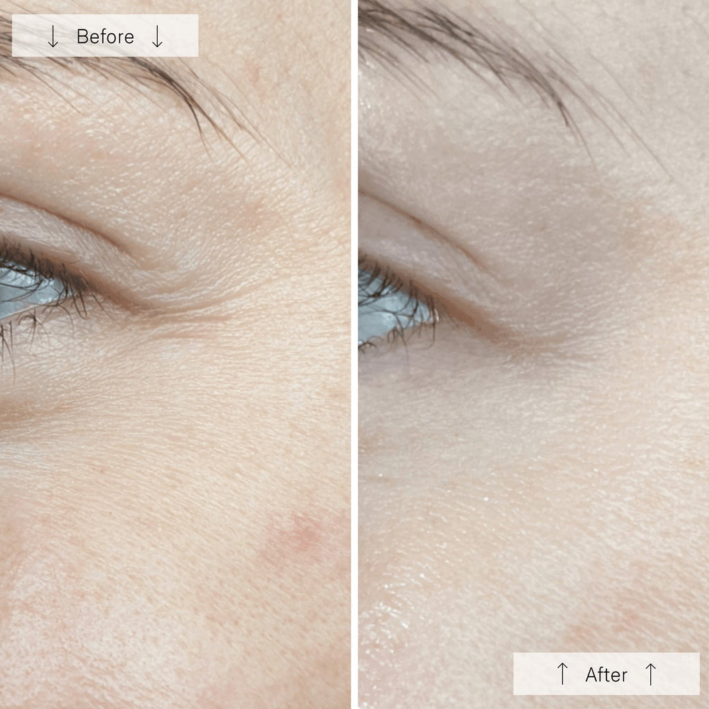 Omnilux Contour - Anti-Ageing Led Light Therapy