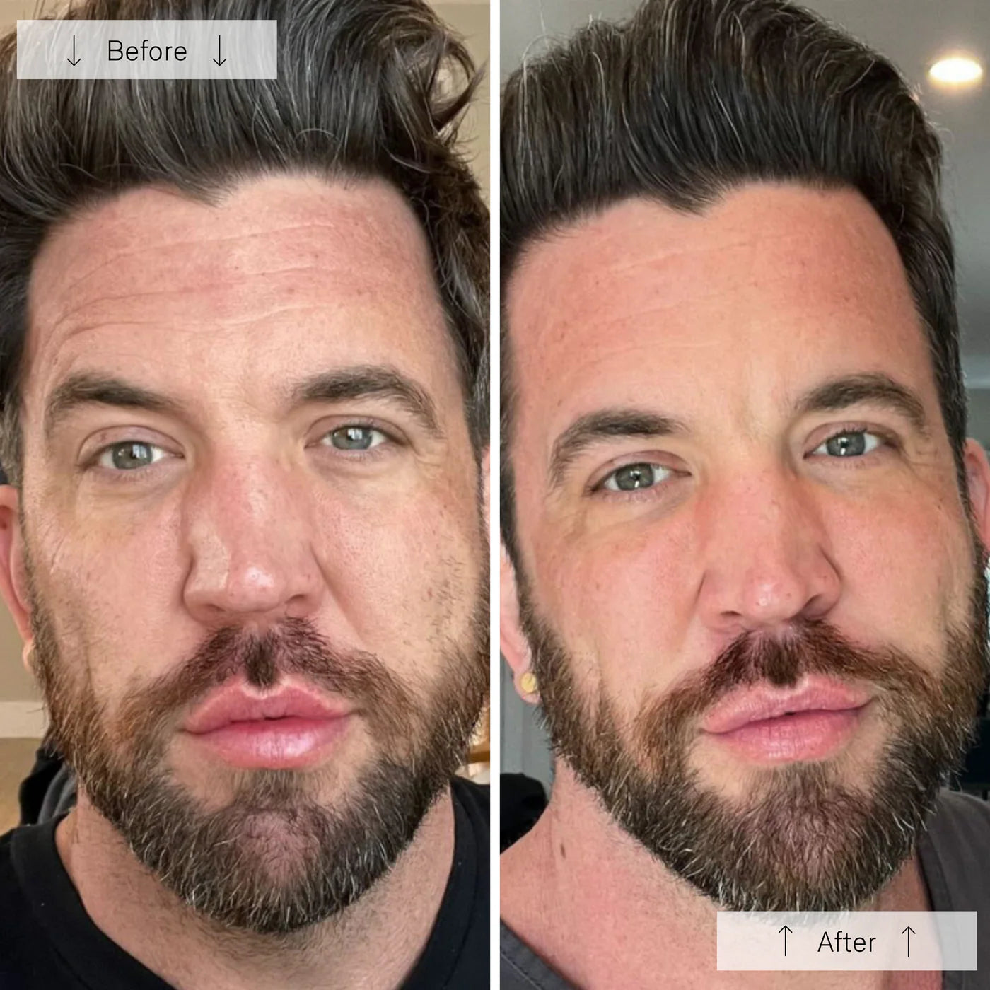 Omnilux Men- Anti-Ageing Led Light Therapy