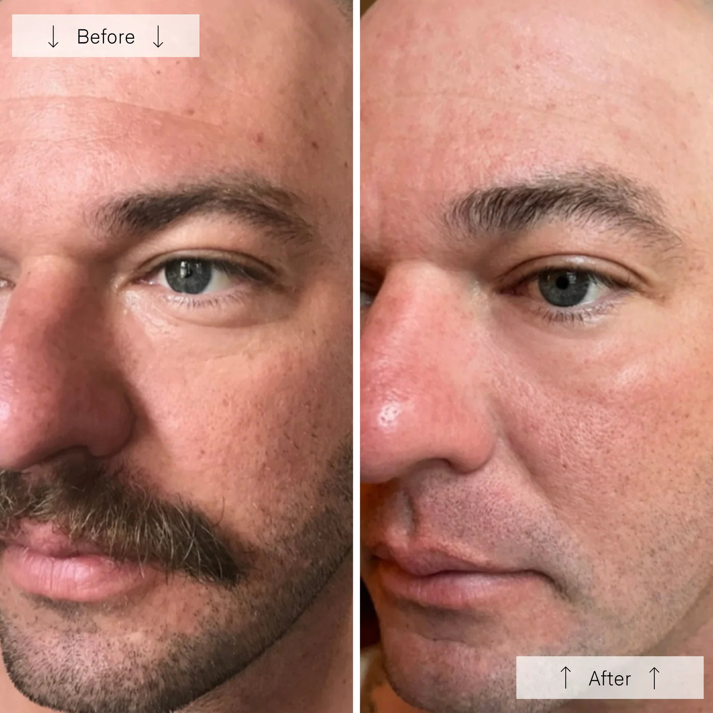 Omnilux Men- Anti-Ageing Led Light Therapy