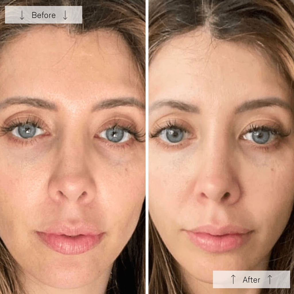 Omnilux Contour - Anti-Ageing Led Light Therapy